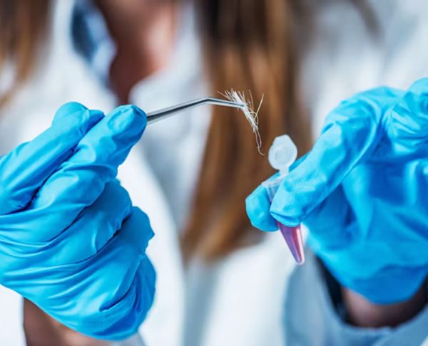 prueba-de-adn-con-exhumacion-de-cadaver