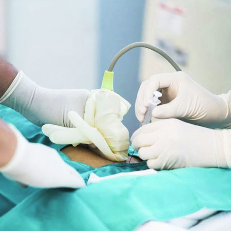 prueba-prenatal-invasiva-biogenes